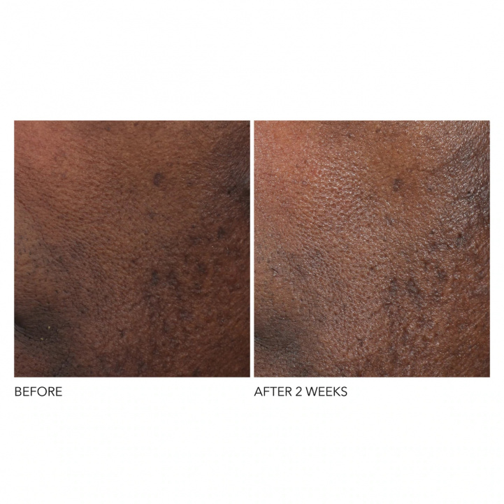 Advaced Retinol+Ferulic Overnight Wrinkle Treatment i gruppen Hudvård hos COW parfymeri AB (-572680)