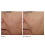 Advaced Retinol+Ferulic Overnight Wrinkle Treatment Advaced Retinol+Ferulic Overnight Wrinkle Treatment