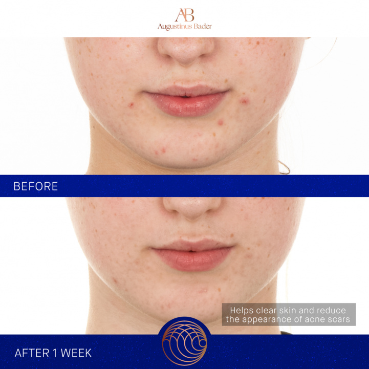 The Retinol Serum i gruppen Hudvård / Serum hos COW parfymeri AB (101236)