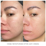 Skin Activator Rollerball