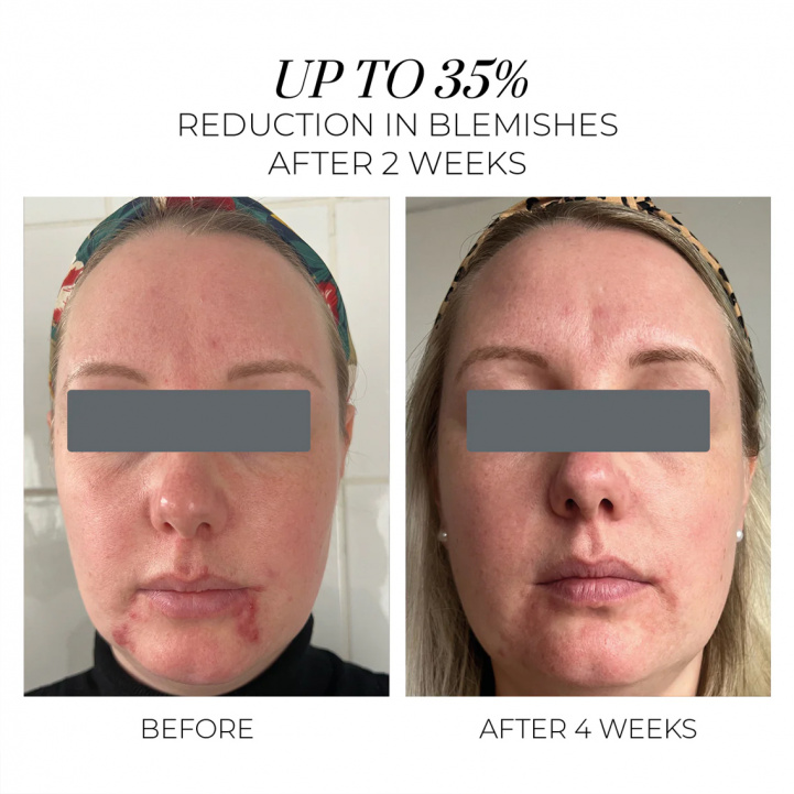 Violet Water Clearing Cleanser in the group Skincare / Cleansers at COW parfymeri AB (101467)