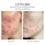 Violet Water BHA Clarifying Treatment Tonic