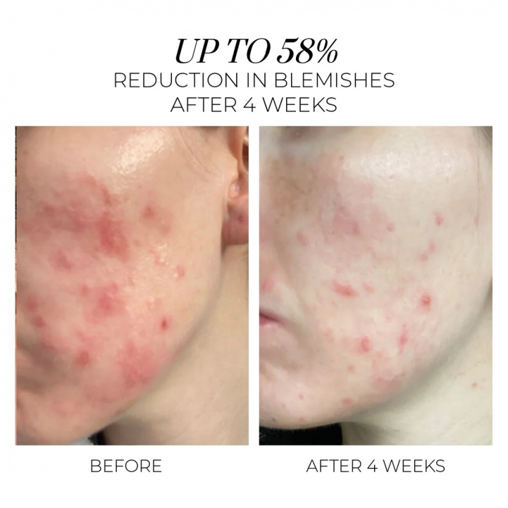 Violet Water BHA Clarifying Treatment Tonic i gruppen Hudvård / Rengöring hos COW parfymeri AB (101468)