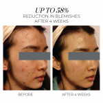 Violet Water Hydra Gel Clarifying Daily Moisturizer