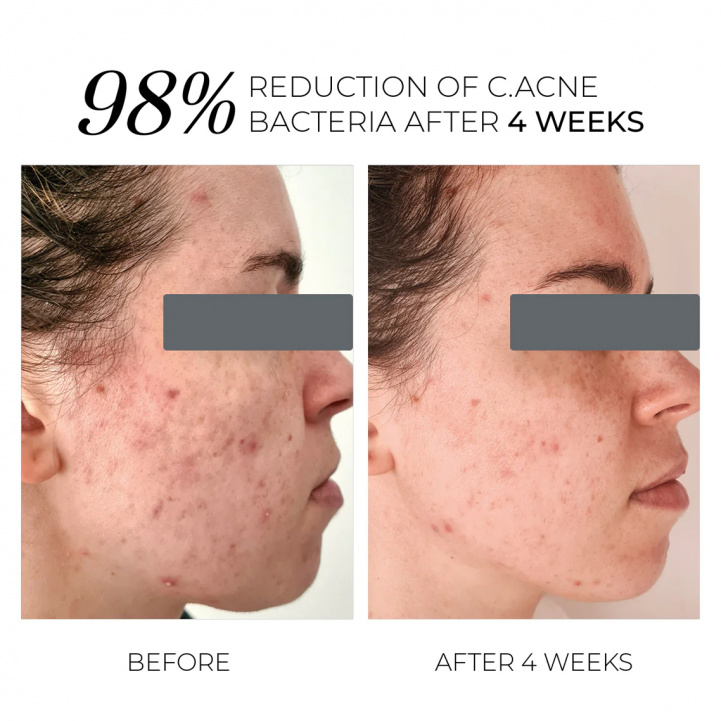 Violet Water D-Spot in the group Skincare / Serum at COW parfymeri AB (101470)