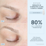 NuFACE + Eye and Lip Enhancer NuFACE + Eye and Lip Enhancer