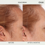 Scalp Serum