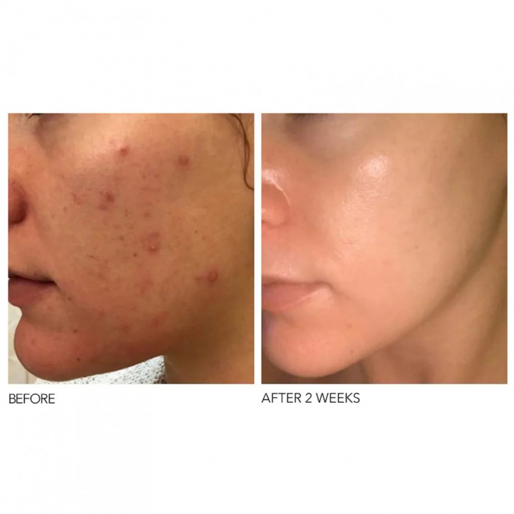 Alpha Beta Daily Face Peel Extra Strength Formula 2 steps- Packettes 5 pk i gruppen Hudvård / Travel Size hos COW parfymeri AB (545210)