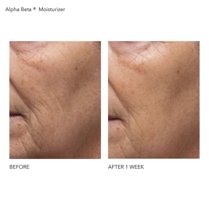Alpha Beta Daily Moisturizer in the group Skincare / Moisturizers at COW parfymeri AB (561910)