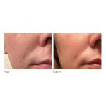 Dr X Blemish Solutions Breakout Clearing Gel