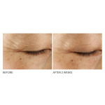 Advanced Retinol + Ferulic Triple Correction Eye Serum