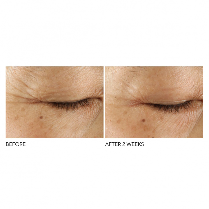 Advanced Retinol + Ferulic Triple Correction Eye Serum i gruppen Hudvård hos COW parfymeri AB (573080)