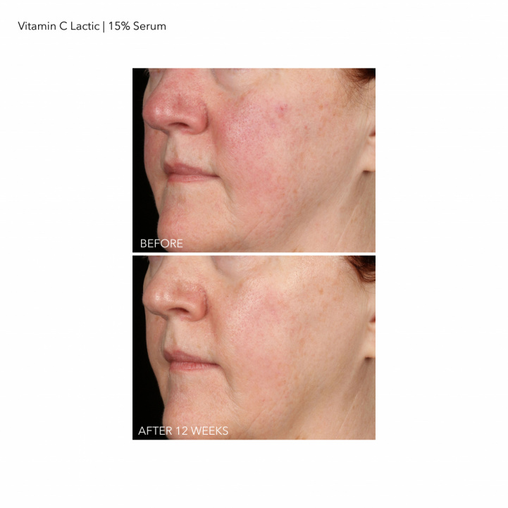 Vitamin C Lactic Firm and Bright Serum i gruppen Hudvård / Serum hos COW parfymeri AB (588680)