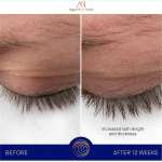The Eyebrow and Lash Enhancing Serum The Eyebrow and Lash Enhancing Serum