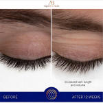 The Eyebrow and Lash Enhancing Serum The Eyebrow and Lash Enhancing Serum